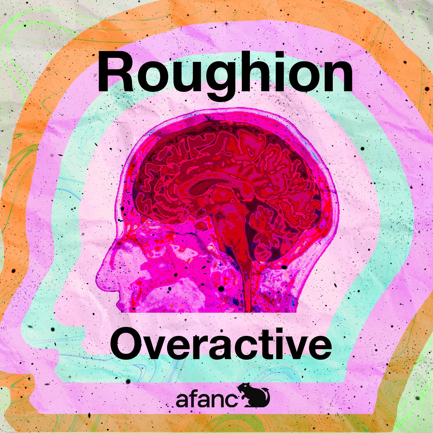 Постер альбома Overactive
