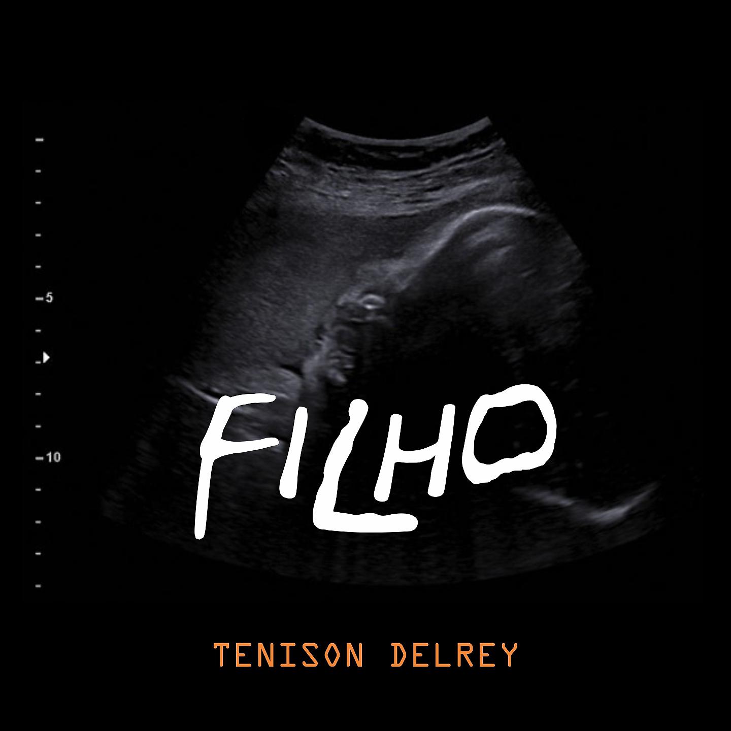 Постер альбома Filho