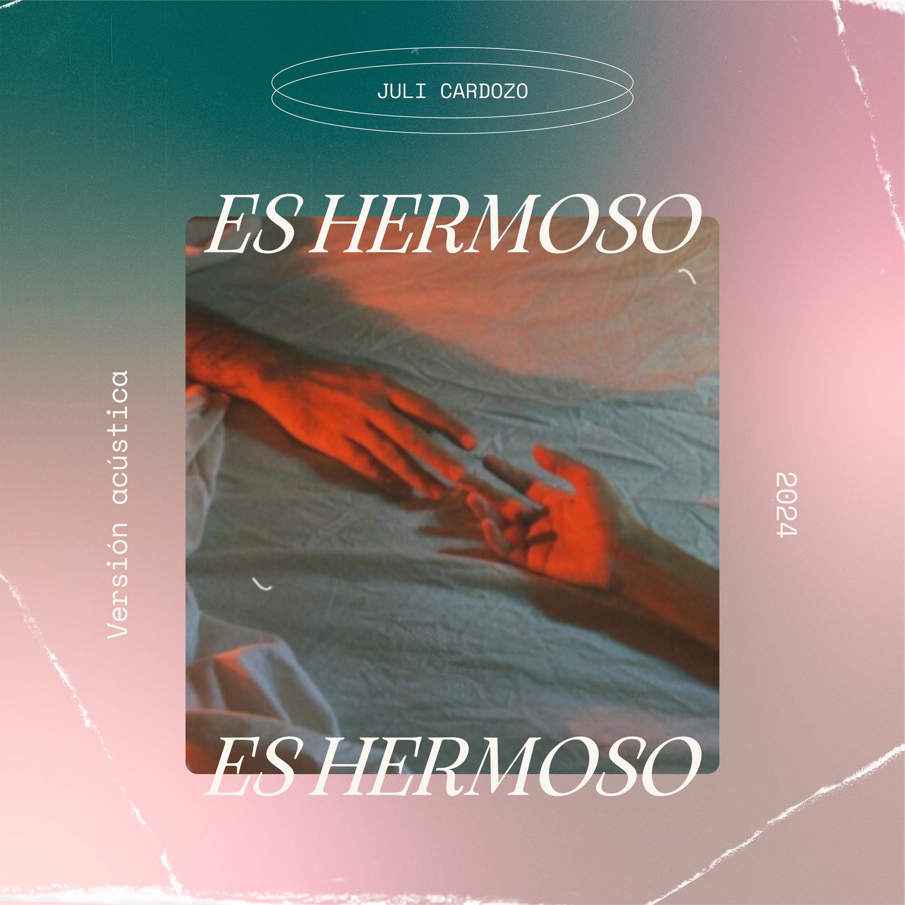 Постер альбома Es Hermoso