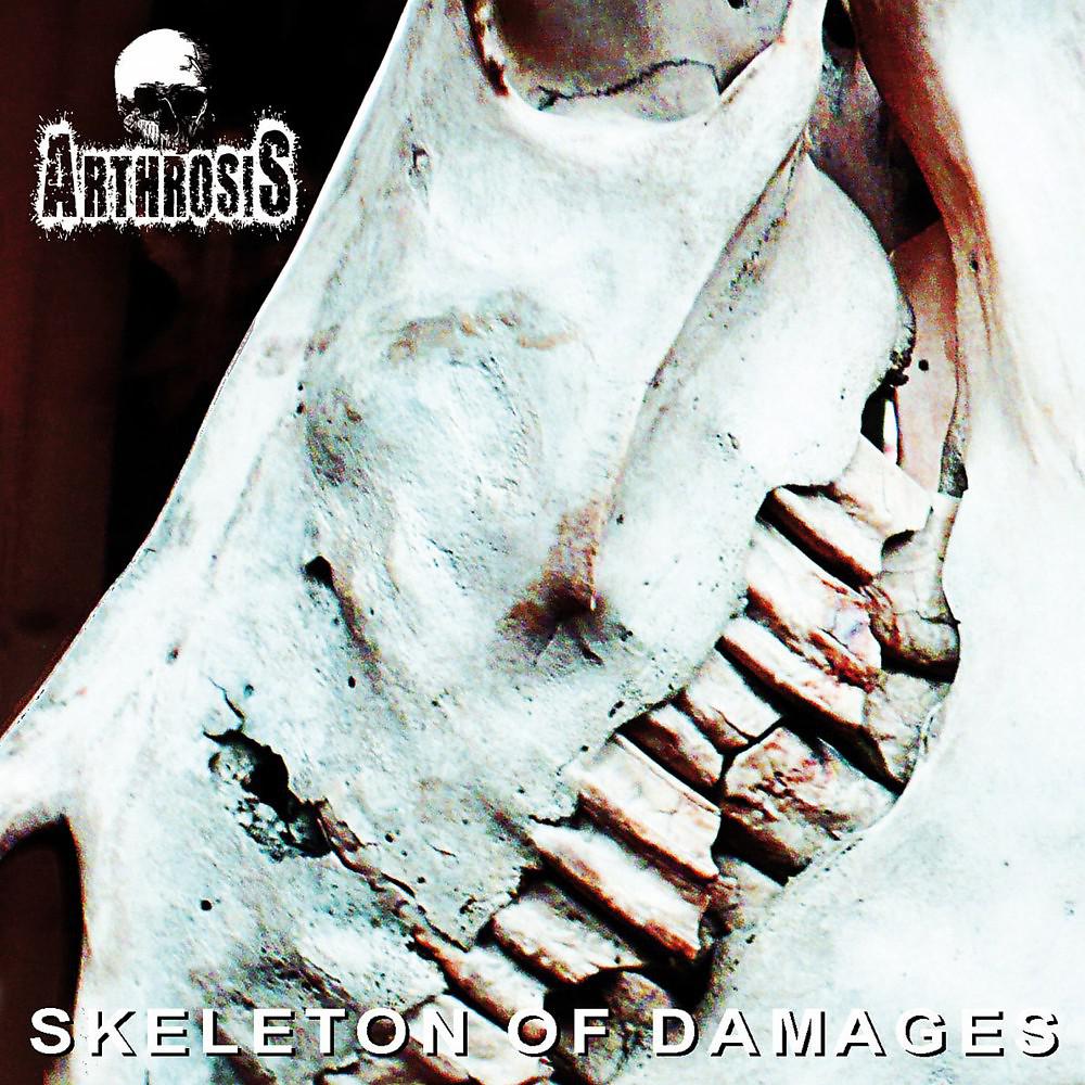 Постер альбома Skeleton of Damages