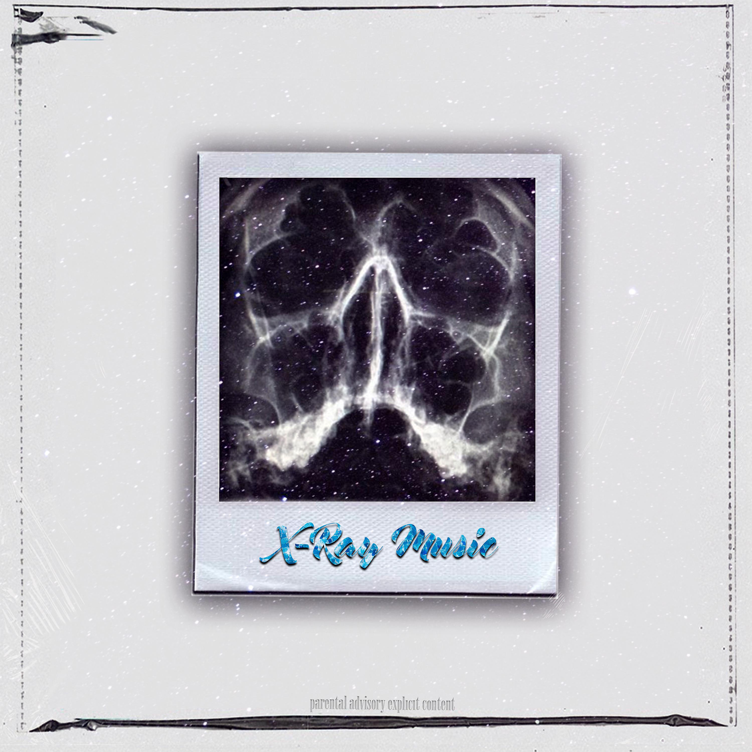 Постер альбома X-Ray Music