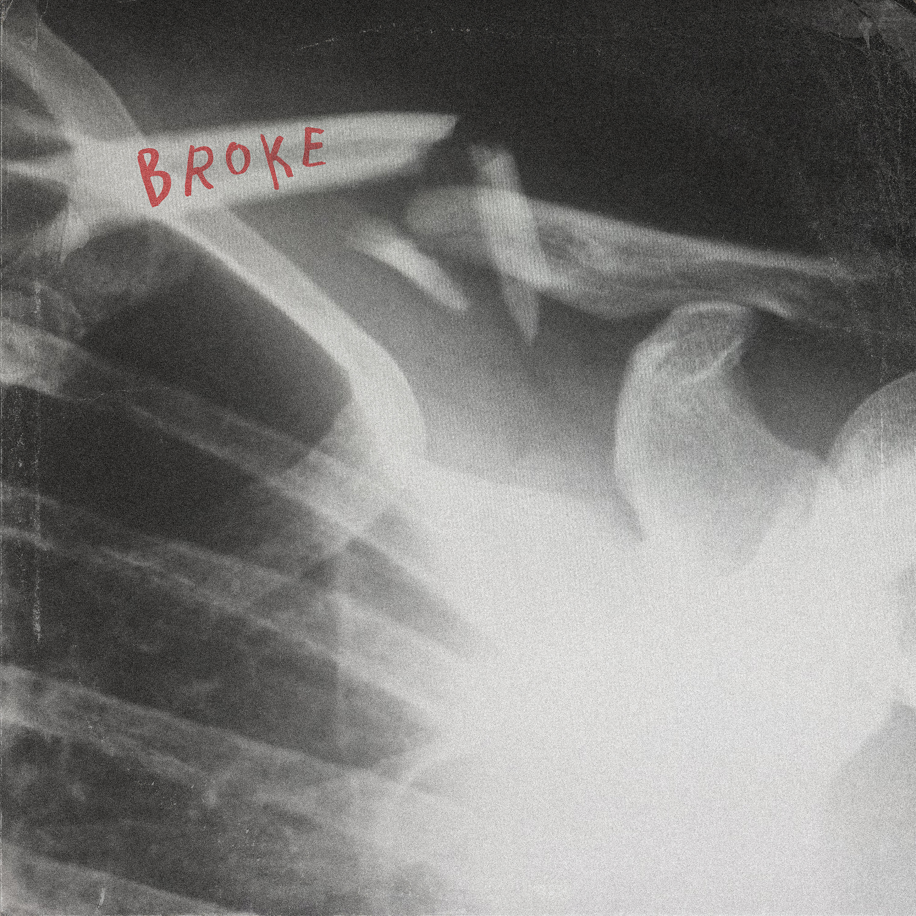 NIXX - BROKE