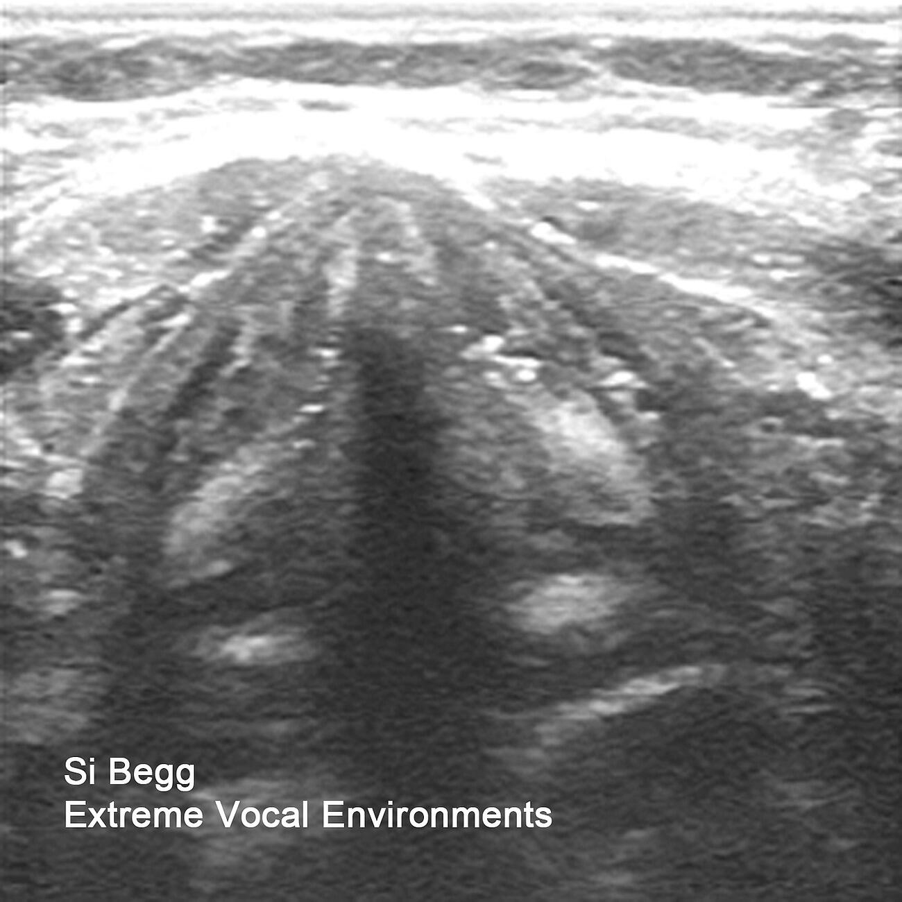 Si Begg - Vocal Location 4