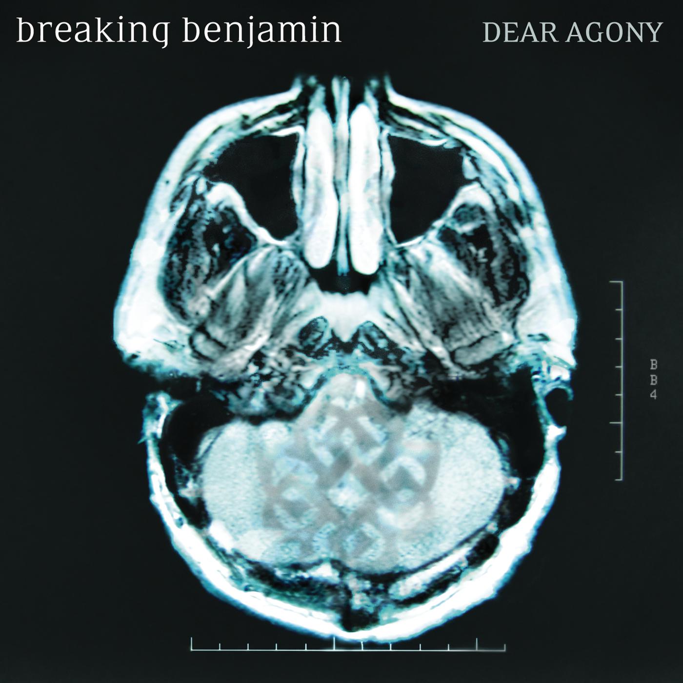 Постер альбома Dear Agony