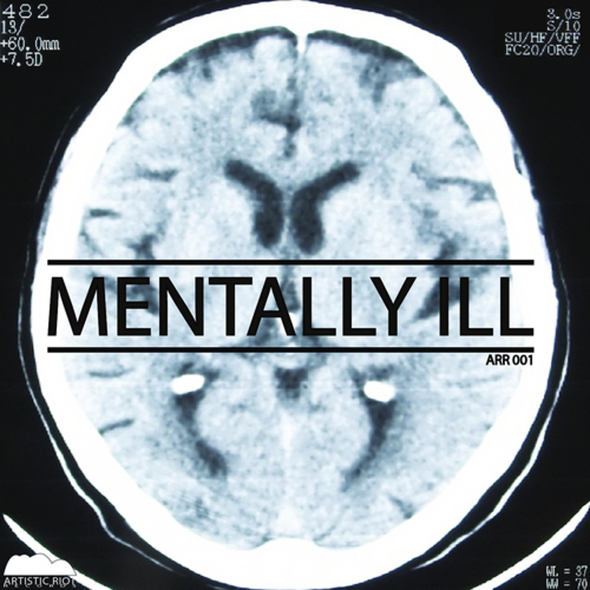 Постер альбома Mentally ill EP
